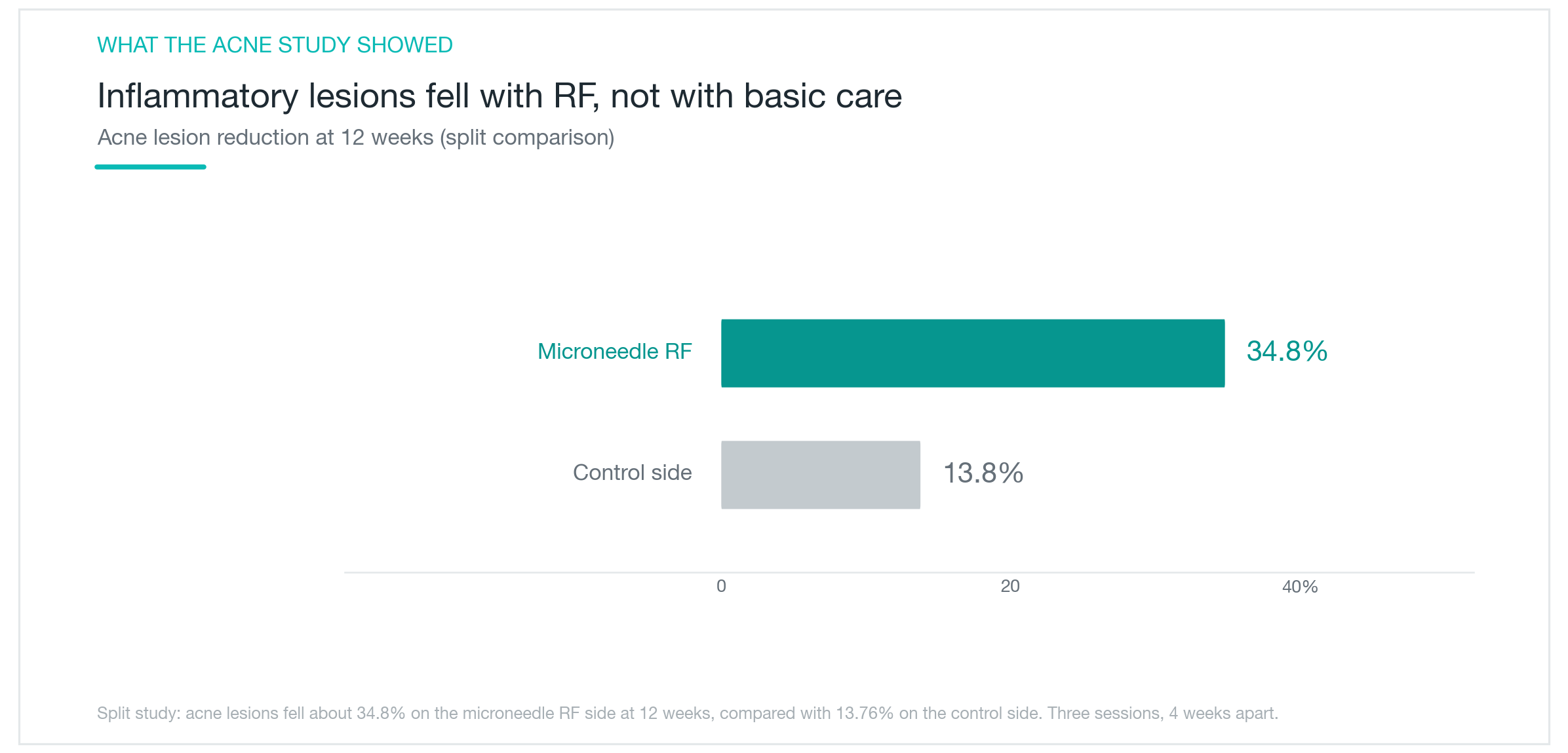 Microneedle RF tipe AGNES mengurangi lesi jerawat inflamasi sekitar 34,8% di sisi yang ditreatment pada minggu ke-12, dibanding 13,76% di sisi kontrol