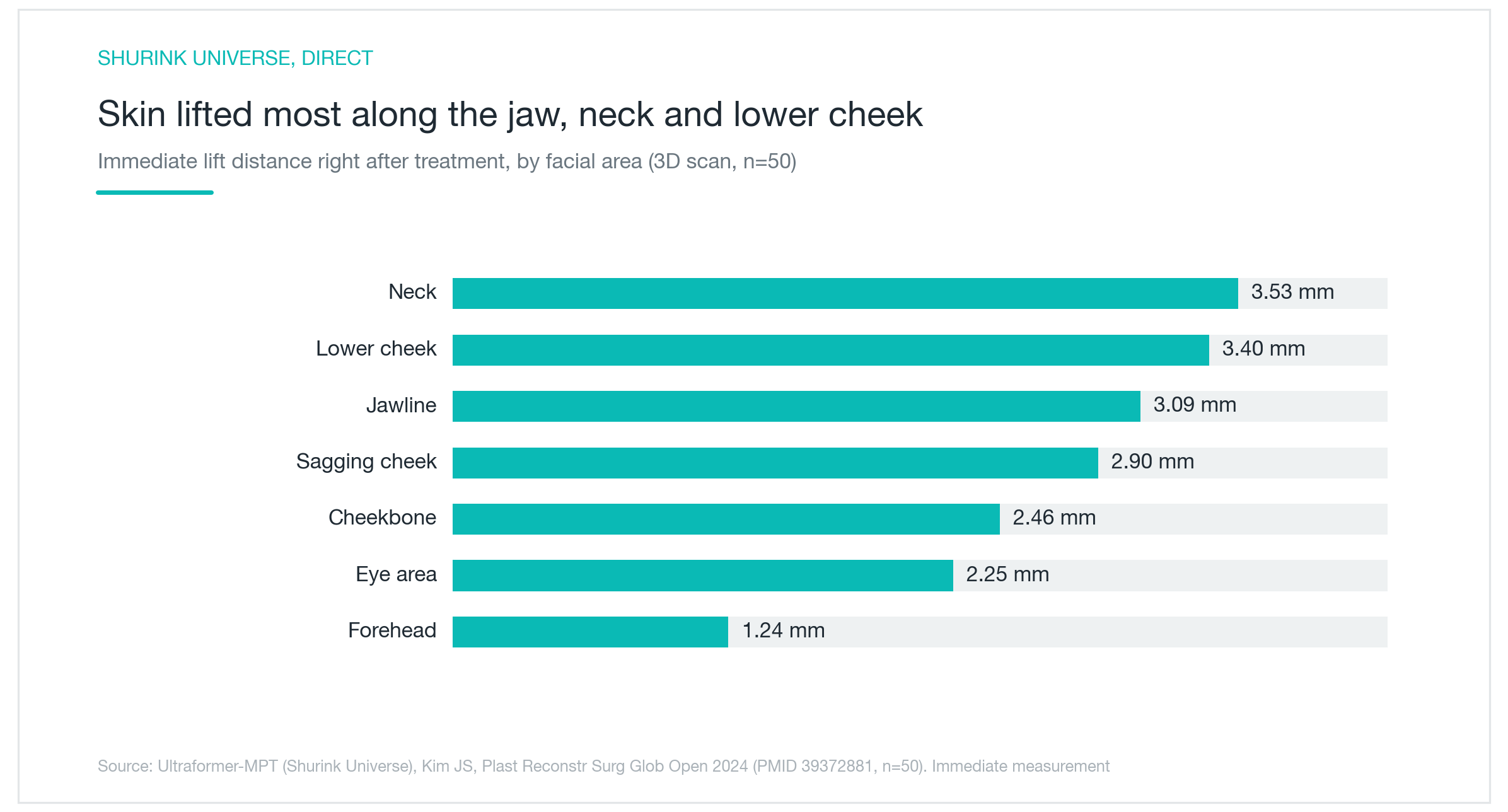 Chart: Ultraformer MPT immediate lift distance by facial zone — neck 3.53mm, posterior cheek 3.40mm, mandibular border 3.09mm, and others (Kim 2024, device-specific clinical study, n=50, immediate post-procedure measurement)