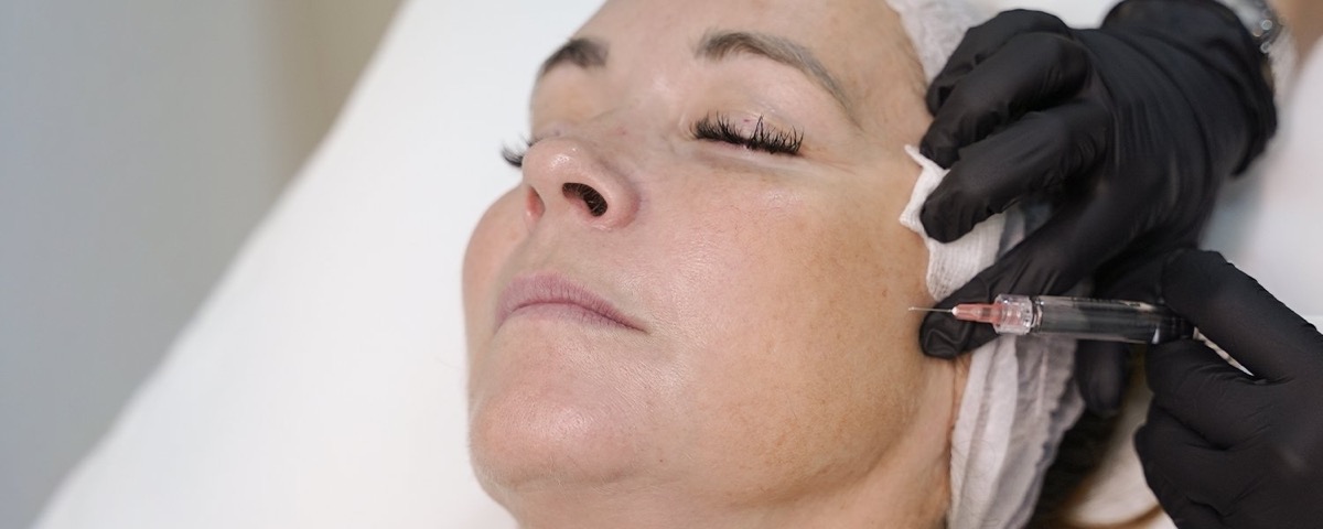 SkinVive treatment in progress or injection syringe